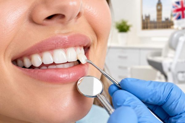 Composite Bonding Cost UK: 2026 Prices, Benefits, Procedure and What to Expect